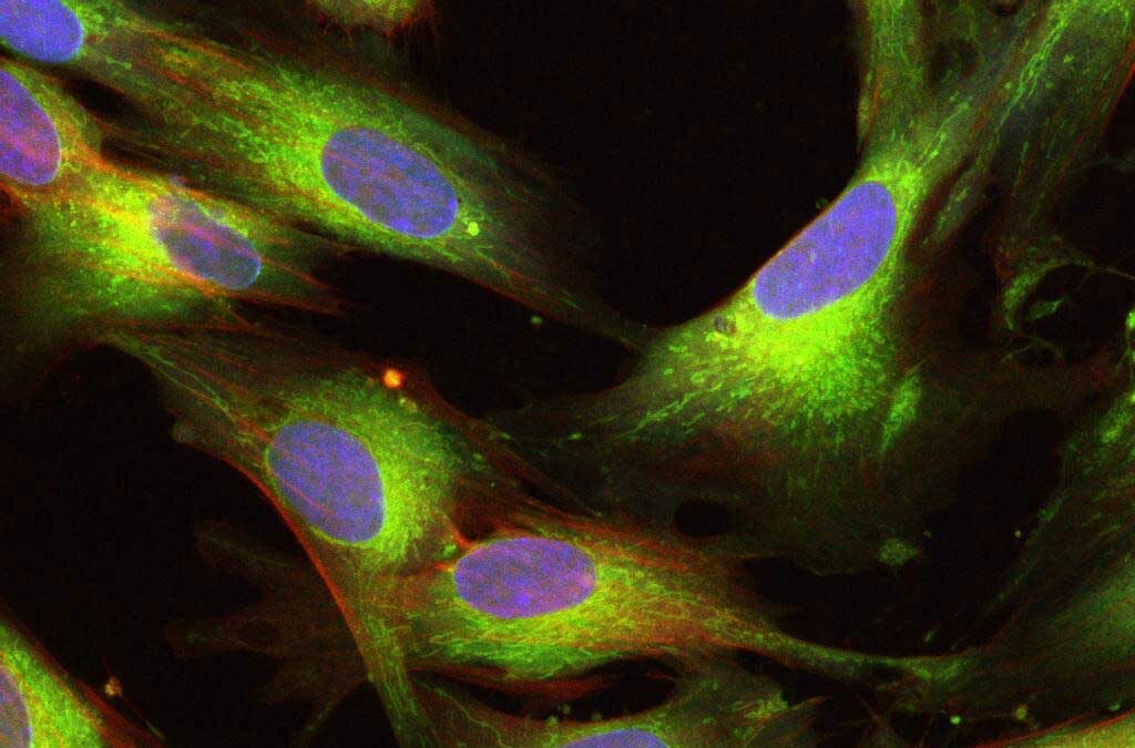 Стволовые клетки UCMSC
